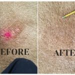 A before and after picture of the stain on the carpet.